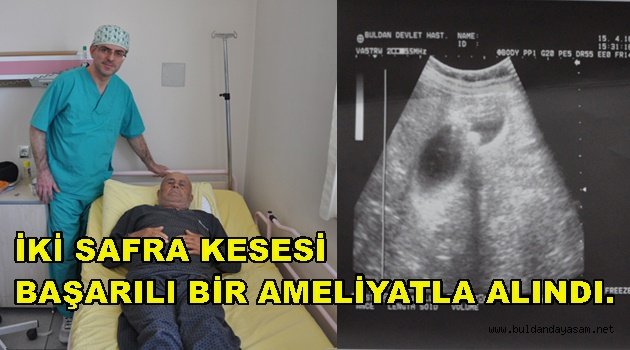 KARIN AĞRISIYLA GELDİ, ÇİFT SAFRA KESESİ ÇIKTI.