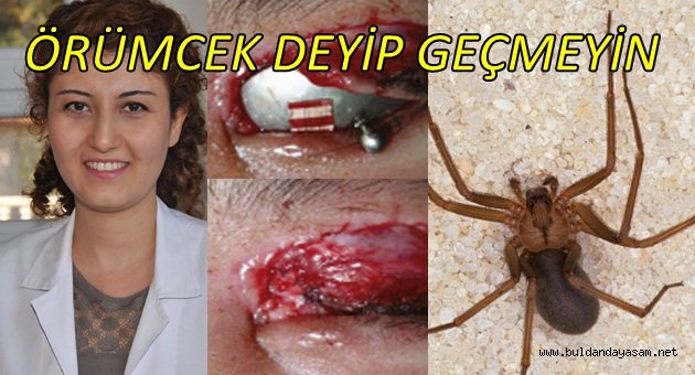 ÖRÜMCEKLERE DİKKAT